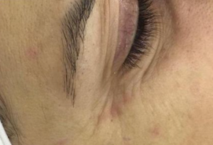 Kontroll i lekures tuaj 